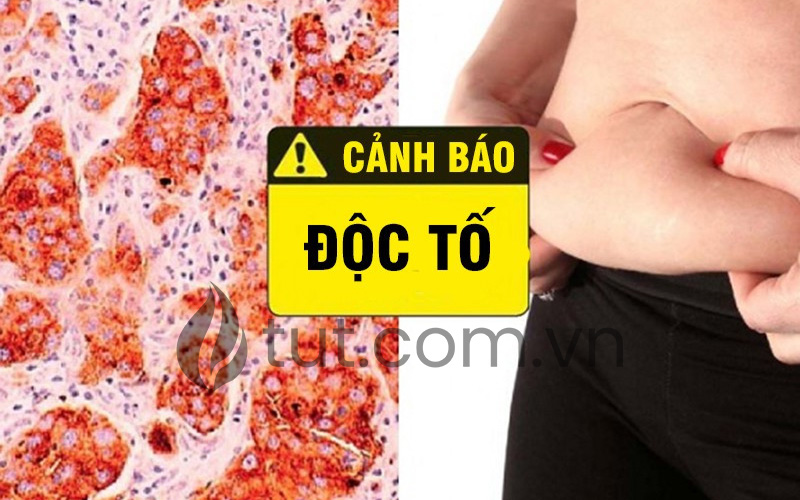 Tích tụ độc tố trong cơ thể